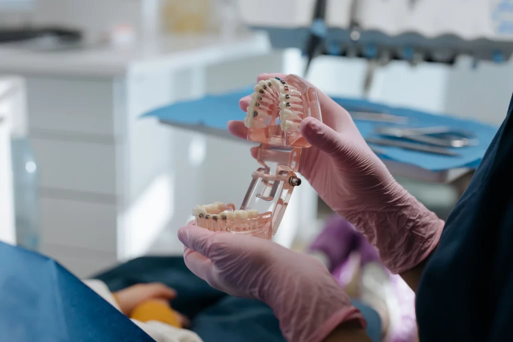 Netaisyklingas sąkandis: požymiai, tipai ir gydymas
